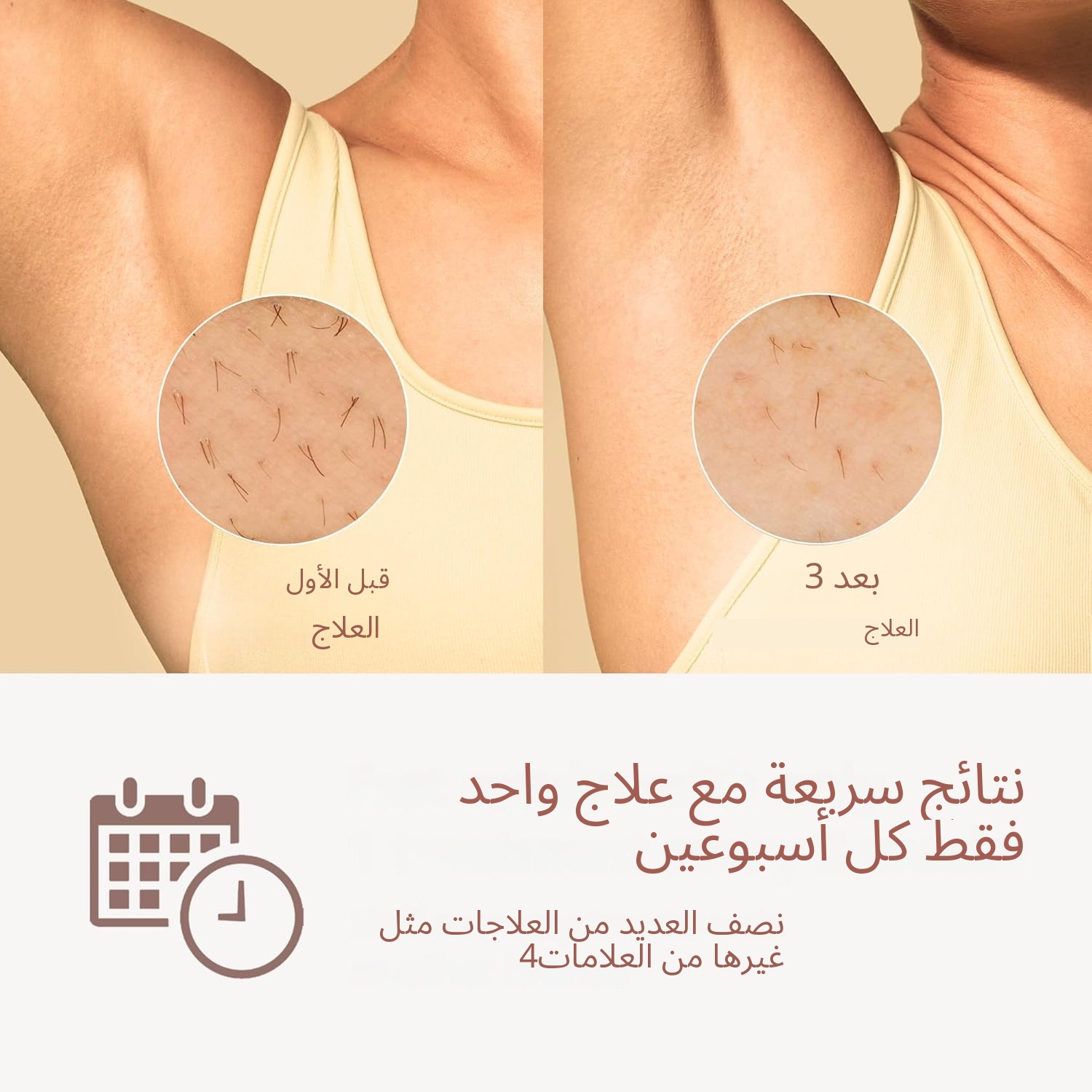 أحدث وصول عام 2026 جهاز إزالة الشعر بالليزر يحقق إزالة الشعر بشكل دائم الكمية محدودة جداً أحدث وصول عام 2026 جهاز إزالة الشعر بالليزر يحقق إزالة الشعر بشكل دائم الكمية محدودة جداً